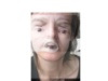 OAugen4